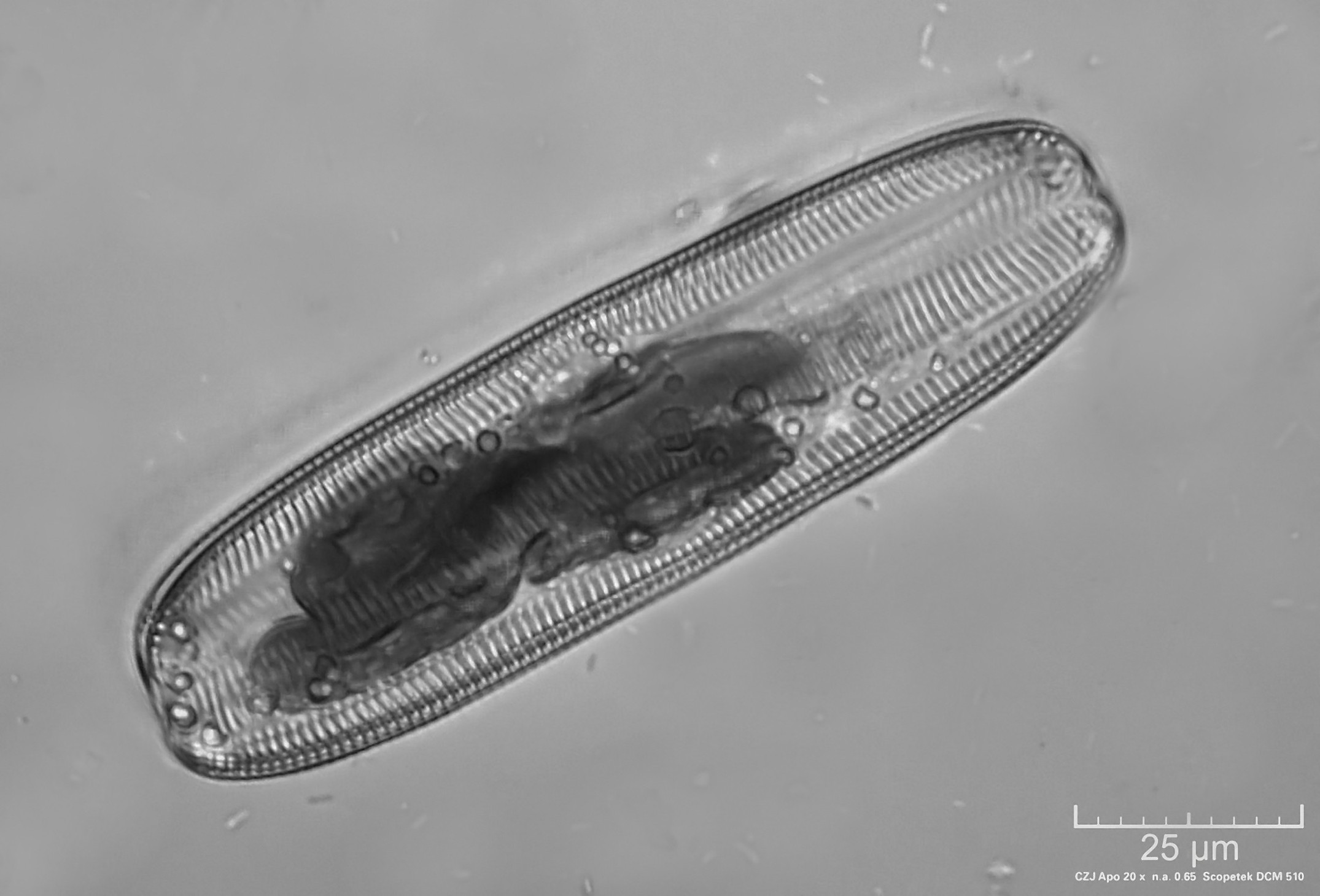 Pinnularia